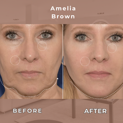 SilquéLift™ - Elevate Your Elegance — A Seamless Lift, Redefined.